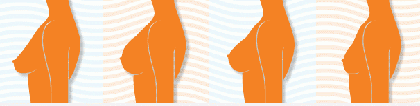 Which Type of Breast Shape Is Yours?